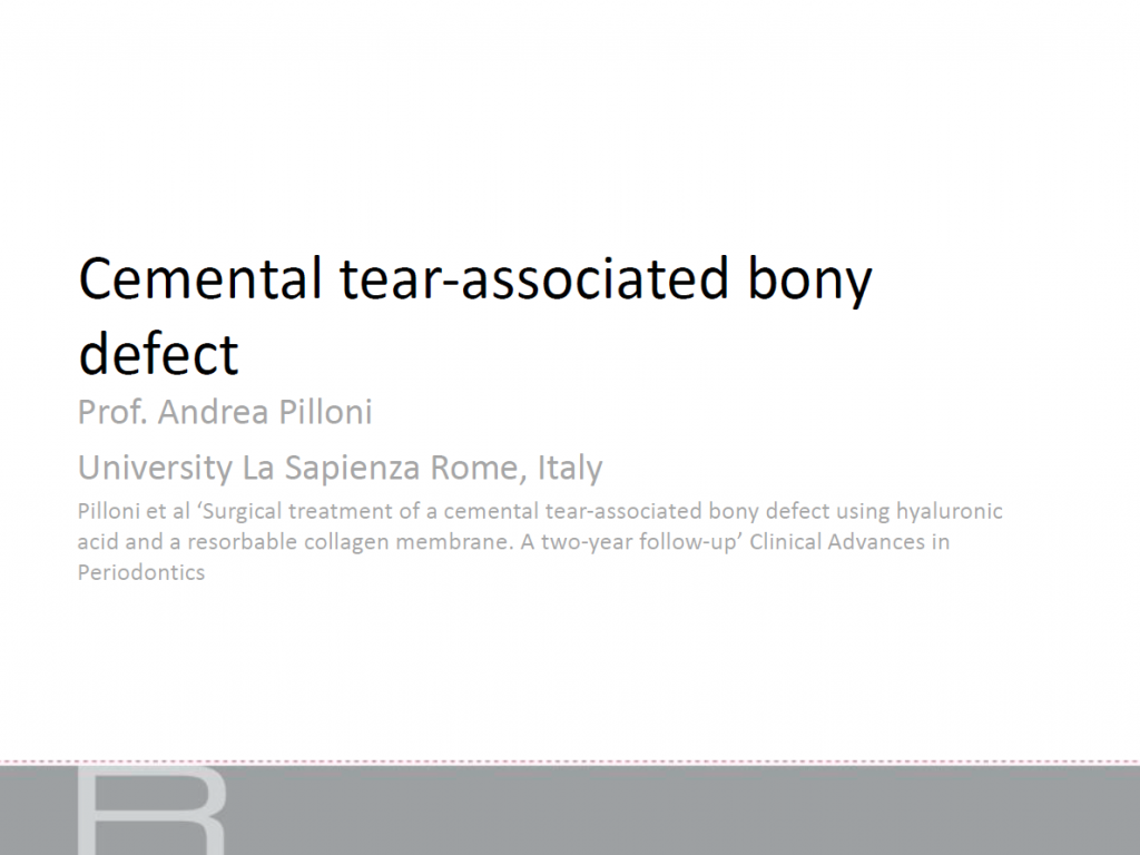 SMARTBRANE Cemental tear-associated bony defect