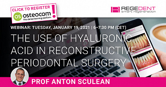 Webinar: The use of hyaluronic acid in reconstructive periodontal surgery
